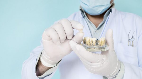 implant dentar ieftin Bucuresti